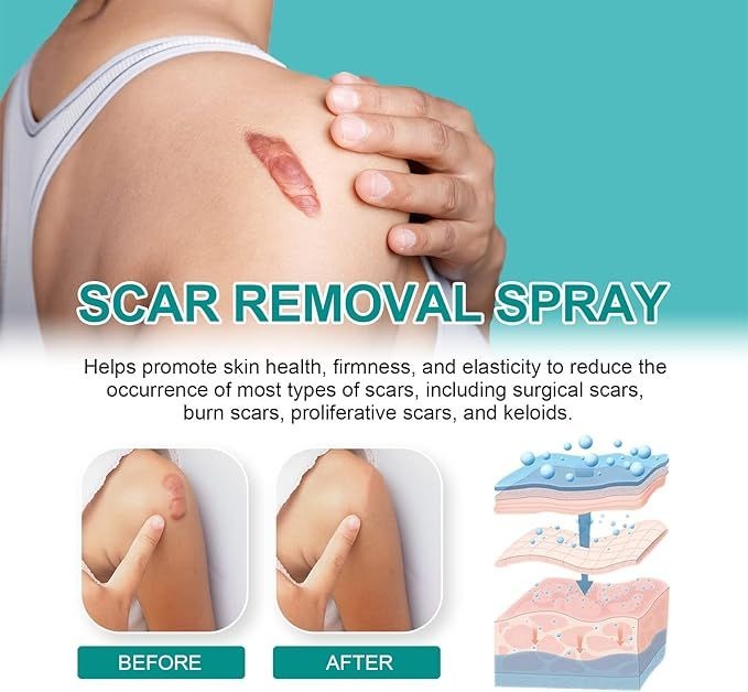 Proregen Medical Scar Removal Spray
