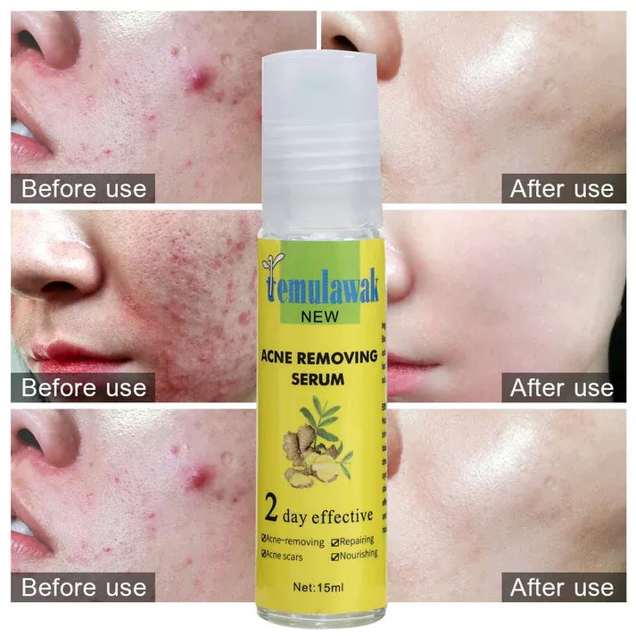 Temulawak Acne Removing Serum