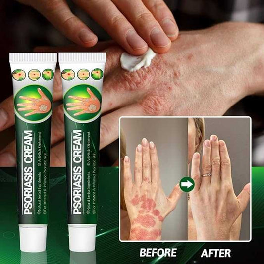 Soothing & Hydrating Relief for Dry, Irritated Skin