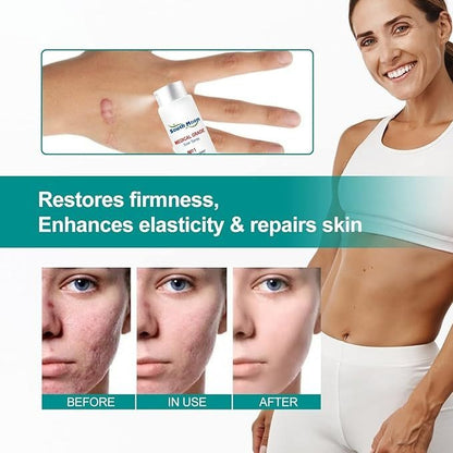 Proregen Medical Scar Removal Spray