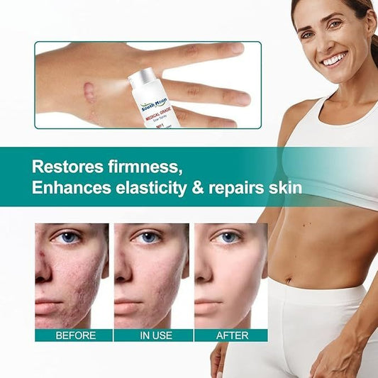 Proregen Medical Scar Removal Spray