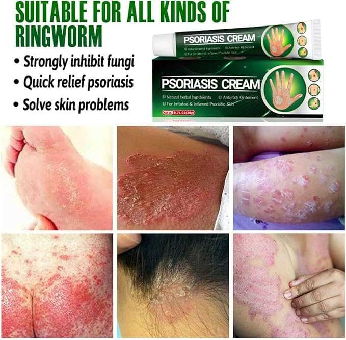 Soothing & Hydrating Relief for Dry, Irritated Skin
