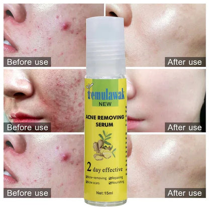 Temulawak Acne Removing Serum