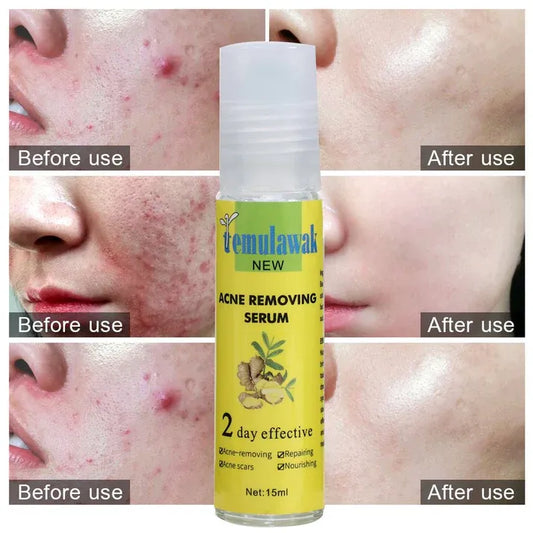 Temulawak Acne Removing Serum