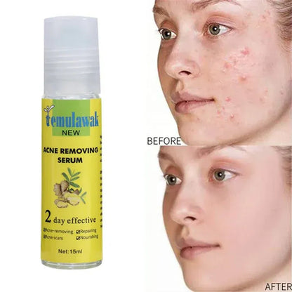 Temulawak Acne Removing Serum