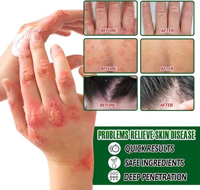 Soothing & Hydrating Relief for Dry, Irritated Skin
