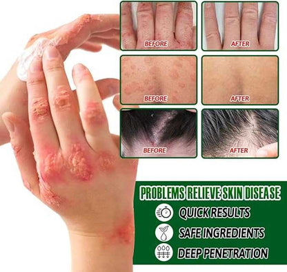 Soothing & Hydrating Relief for Dry, Irritated Skin